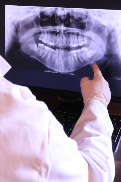Best Emergency Root Canal Treatment in Laurel, MS