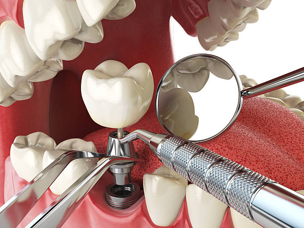 Best Pediatric Emergency Dentist in Laurel, MS
